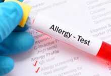 Food Allergy Test