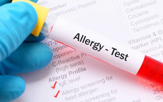 Food Allergy Test